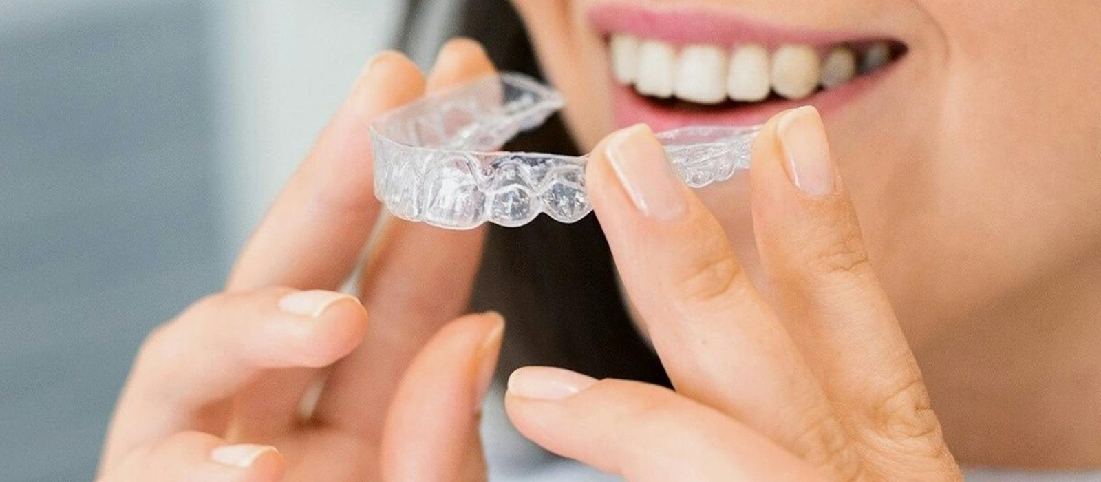 Invisalign